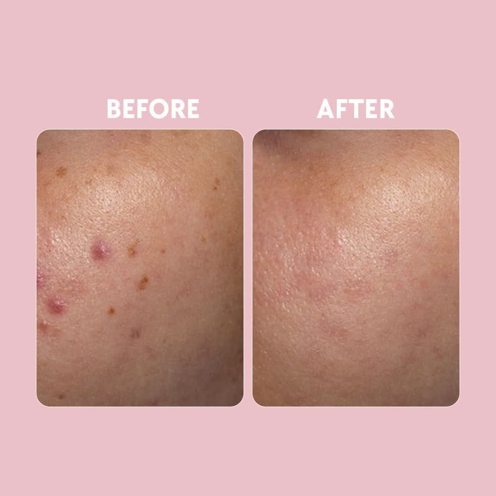 Posch Vitamin C Brightening Serum 30ml